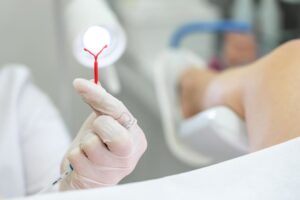 O que devo saber antes de colocar o DIU (Dispositivo intrauterino)